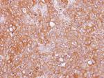 AdoHcyase 3 Antibody in Immunohistochemistry (Paraffin) (IHC (P))