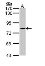 AdoHcyase 3 Antibody in Western Blot (WB)