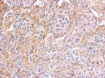 PPFIBP2 Antibody in Immunohistochemistry (Paraffin) (IHC (P))