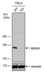 ROCK1 Antibody