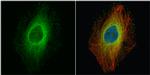 ROCK1 Antibody in Immunocytochemistry (ICC/IF)