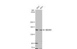 ROCK1 Antibody in Western Blot (WB)