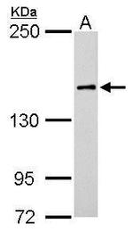 ROCK1 Antibody in Western Blot (WB)