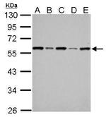 FKBP4 Antibody in Western Blot (WB)