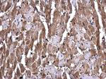 GSTM1 Antibody in Immunohistochemistry (Paraffin) (IHC (P))