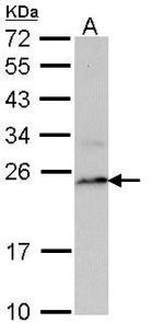PSMB8 Antibody in Western Blot (WB)