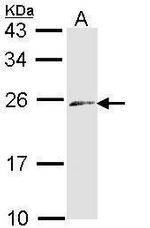 Endothelin 3 Antibody in Western Blot (WB)