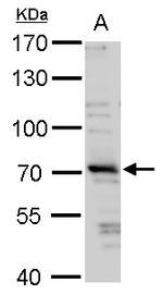 TRIM32 Antibody in Western Blot (WB)