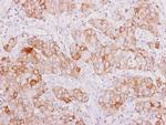 SMAD9 Antibody in Immunohistochemistry (Paraffin) (IHC (P))