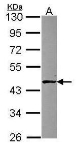 ABH1 Antibody in Western Blot (WB)