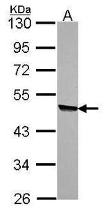 KYNU Antibody in Western Blot (WB)