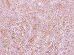 PDIR Antibody in Immunohistochemistry (Paraffin) (IHC (P))