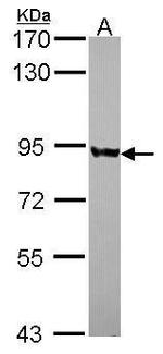 PNPase Antibody in Western Blot (WB)