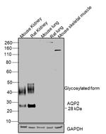 Aquaporin 2 Antibody in Western Blot (WB)