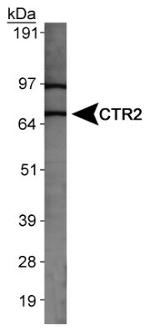 CTR2 Antibody in Western Blot (WB)