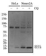 LC3A Antibody in Western Blot (WB)