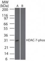 Phospho-HDAC7 (Ser318) Antibody in Western Blot (WB)