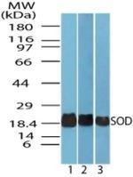 SOD1 Antibody in Western Blot (WB)