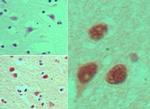 NUP35 Antibody in Immunohistochemistry (Paraffin) (IHC (P))