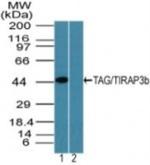 TICAM2 Antibody in Western Blot (WB)