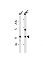 CTDSPL Antibody in Western Blot (WB)