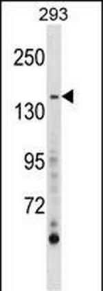 AEBP1 Antibody in Western Blot (WB)