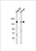 MRP3 Antibody in Western Blot (WB)