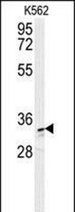 AKR1C3 Antibody in Western Blot (WB)