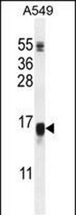 WFDC12 Antibody in Western Blot (WB)