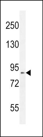 DDX11 Antibody in Western Blot (WB)