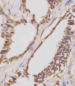 IGF2BP1 Antibody in Immunohistochemistry (Paraffin) (IHC (P))