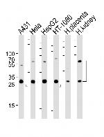 Cathepsin A Antibody in Western Blot (WB)