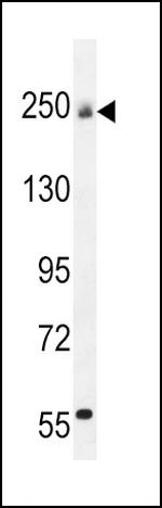 Collagen V Antibody in Western Blot (WB)