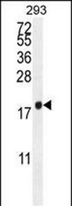 PCOTH Antibody in Western Blot (WB)