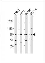 IL12RB2 Antibody in Western Blot (WB)