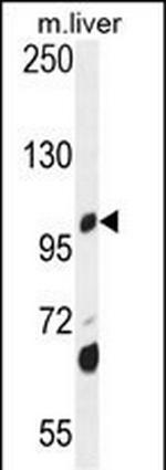 DHTKD1 Antibody in Western Blot (WB)