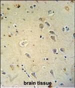 GluR4 Antibody in Immunohistochemistry (Paraffin) (IHC (P))