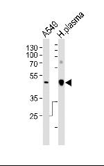 Apolipoprotein J Antibody in Western Blot (WB)