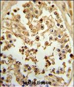 eIF4E Antibody in Immunohistochemistry (Paraffin) (IHC (P))