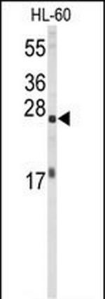 eIF4E Antibody in Western Blot (WB)