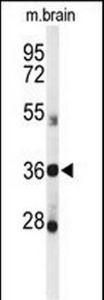 DDO Antibody in Western Blot (WB)