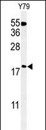 TXNDC12 Antibody in Western Blot (WB)