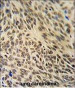 Ku70 Antibody in Immunohistochemistry (Paraffin) (IHC (P))