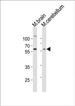 GLD2 Antibody in Western Blot (WB)