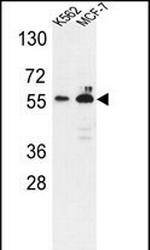 G6PD Antibody in Western Blot (WB)