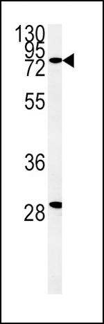 ZFYVE16 Antibody in Western Blot (WB)