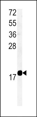 TMEM222 Antibody in Western Blot (WB)