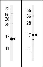 IL-4 Antibody in Western Blot (WB)