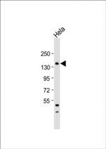 MTMR15 Antibody in Western Blot (WB)