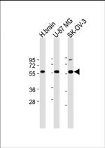 DYNC1LI2 Antibody in Western Blot (WB)